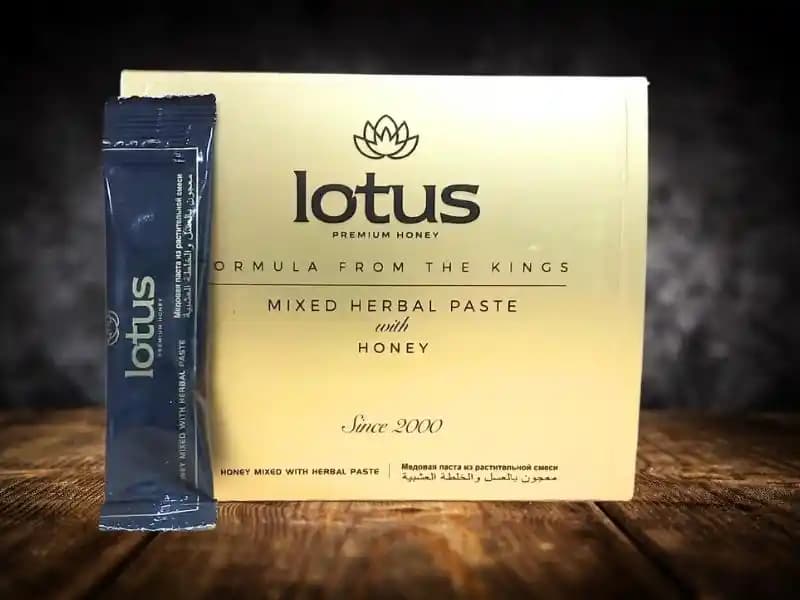 Lotus Araçları, Topluluğu ve Teknik Sorunları Üzerine Kapsamlı İnceleme
