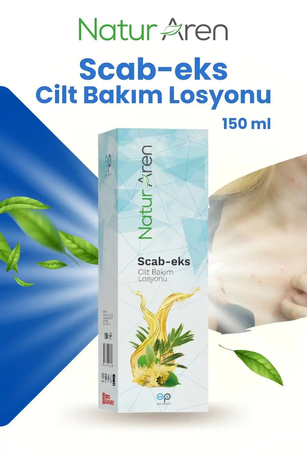 Uyuz Losyonları ve Tedavi Yöntemleri: Etkili Kullanım ve Uzman Önerileri