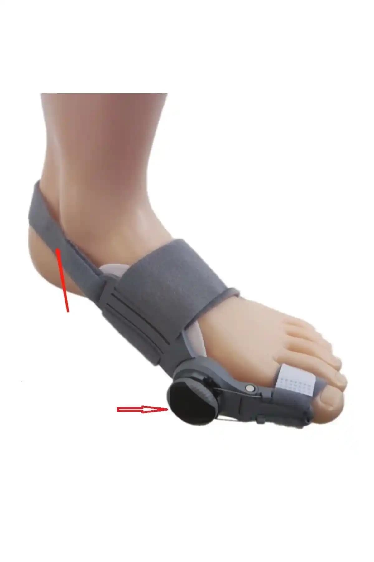 Başarı Ortopedi Ayarlı ve Gece Ateli ile başparmak kemik çıkıntılarını düzeltme yöntemleri