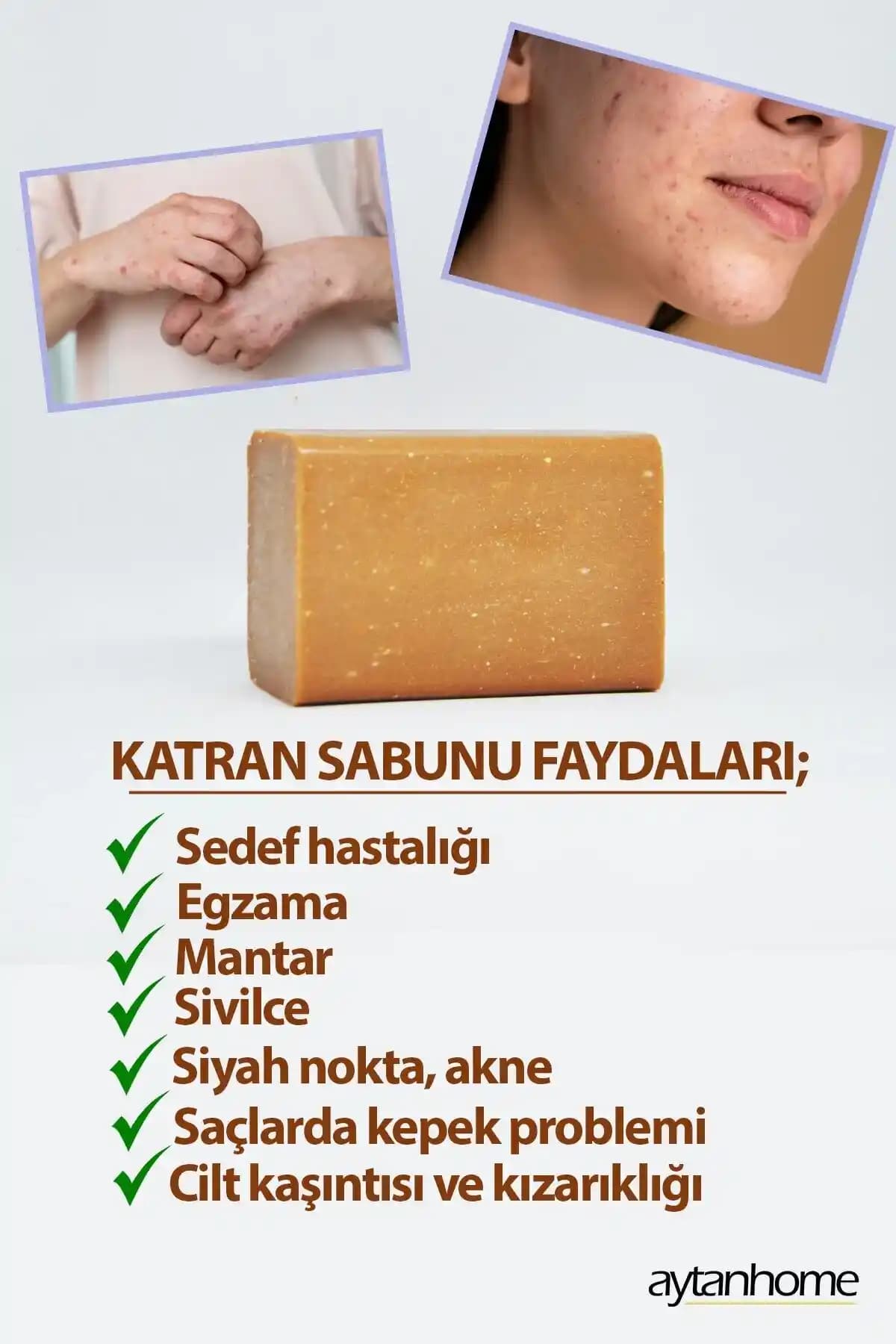 Kükürt Sabunu ve Sivilceyle Mücadelede Etkili Kullanım Yöntemleri